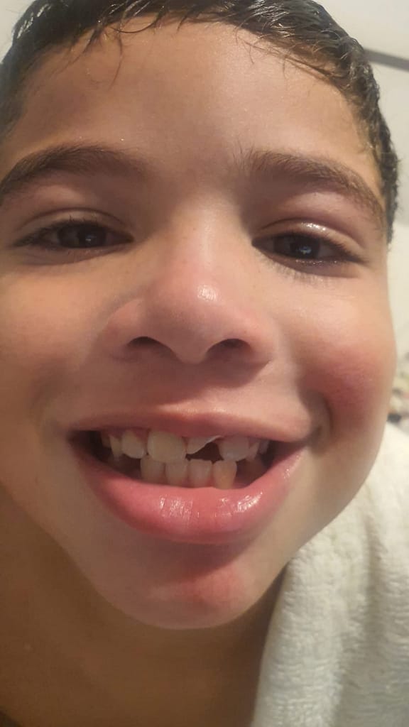 saúde bucal infantil trauma